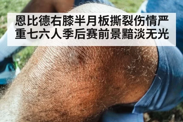 恩比德右膝半月板撕裂伤情严重七六人季后赛前景黯淡无光